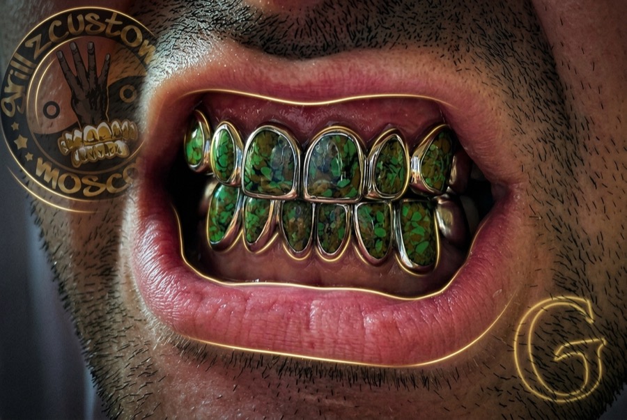Кастомные grillz — работа Grillz Customs