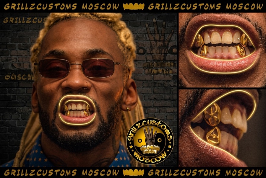 Детальная посадка — работа Grillz Customs